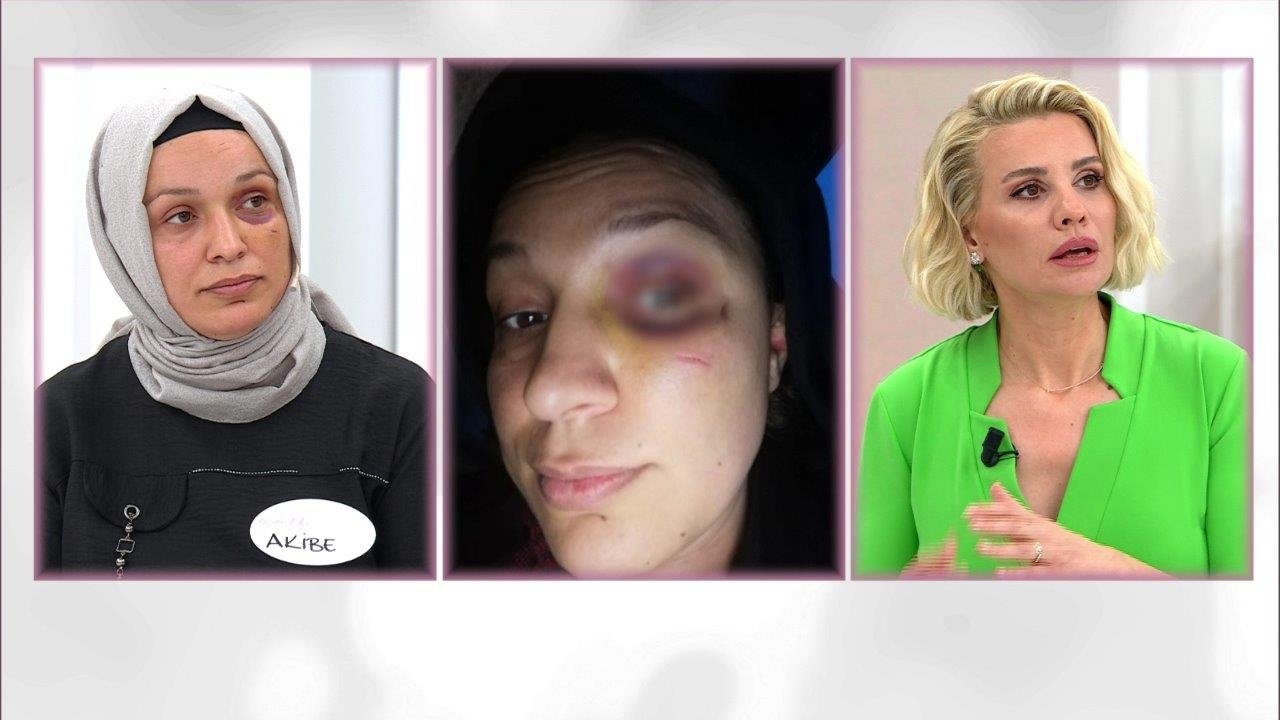 ''Kocam beni öldüresiye dövdü''