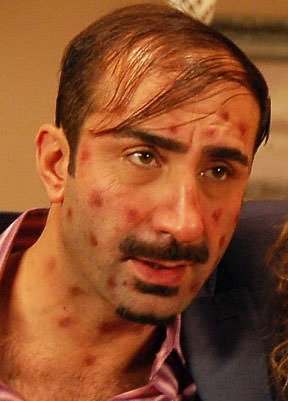 Metin Yıldız  kimdir? Metin Yıldız  Biyografisi