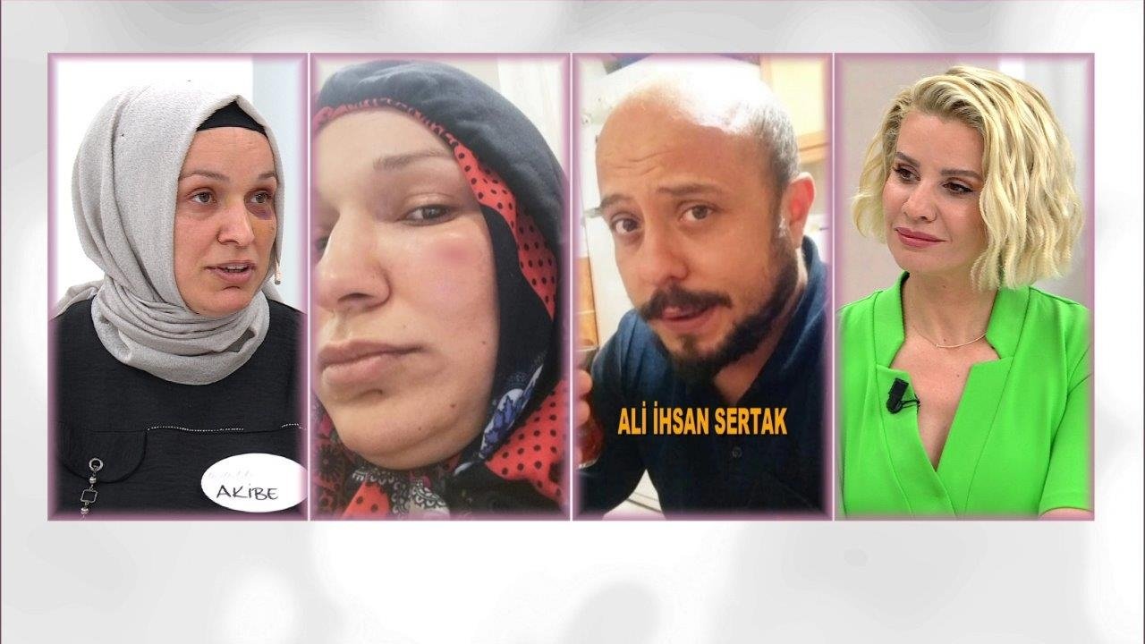 ''Kocam beni öldüresiye dövdü''