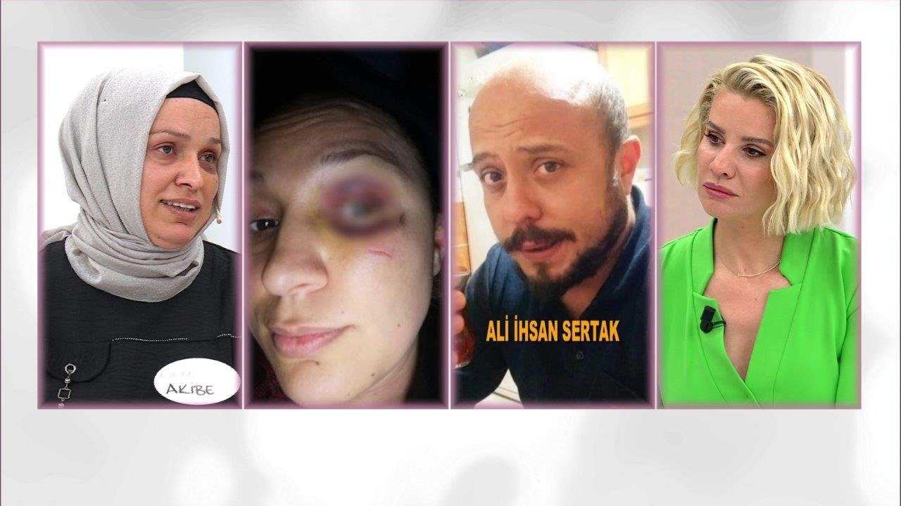 ''Kocam beni öldüresiye dövdü''