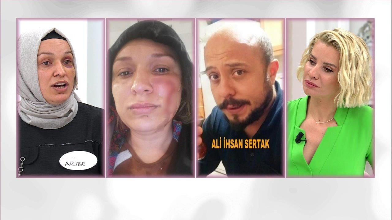 ''Kocam beni öldüresiye dövdü''