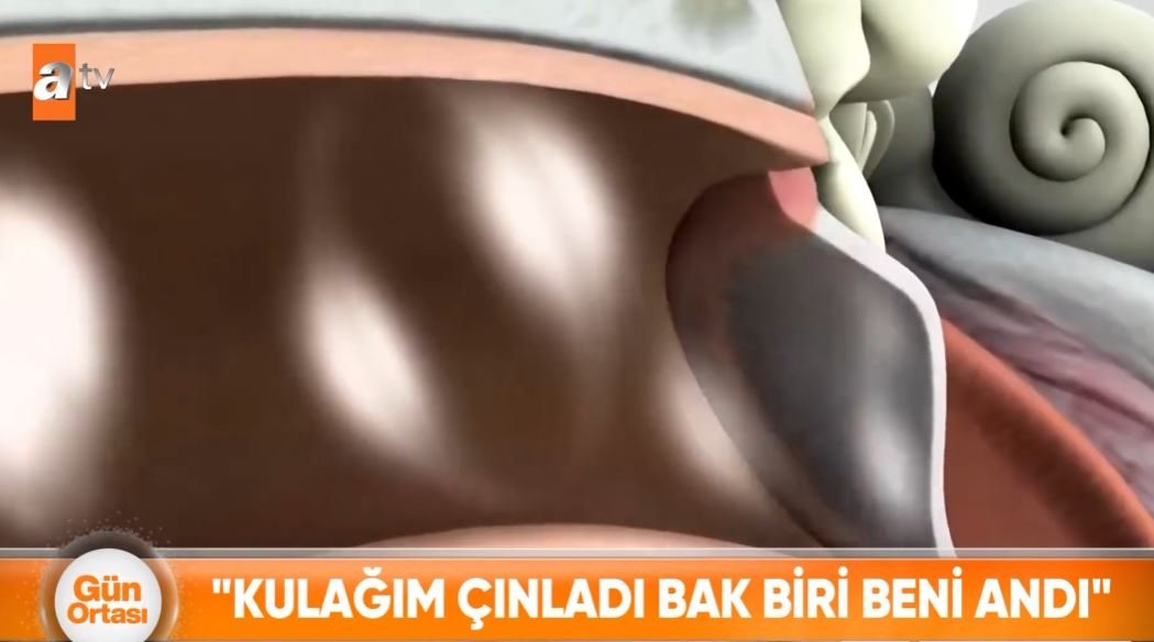 Kulak çınlaması deyip geçmeyin