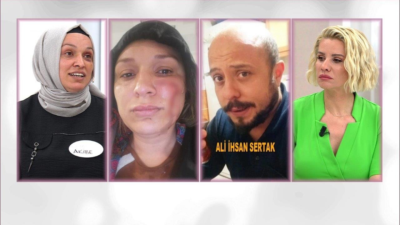 ''Kocam beni öldüresiye dövdü''